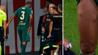 ¿Qué son los bultos vistos en la pierna de Fali tras su lesión en Atlético vs. Cádiz?