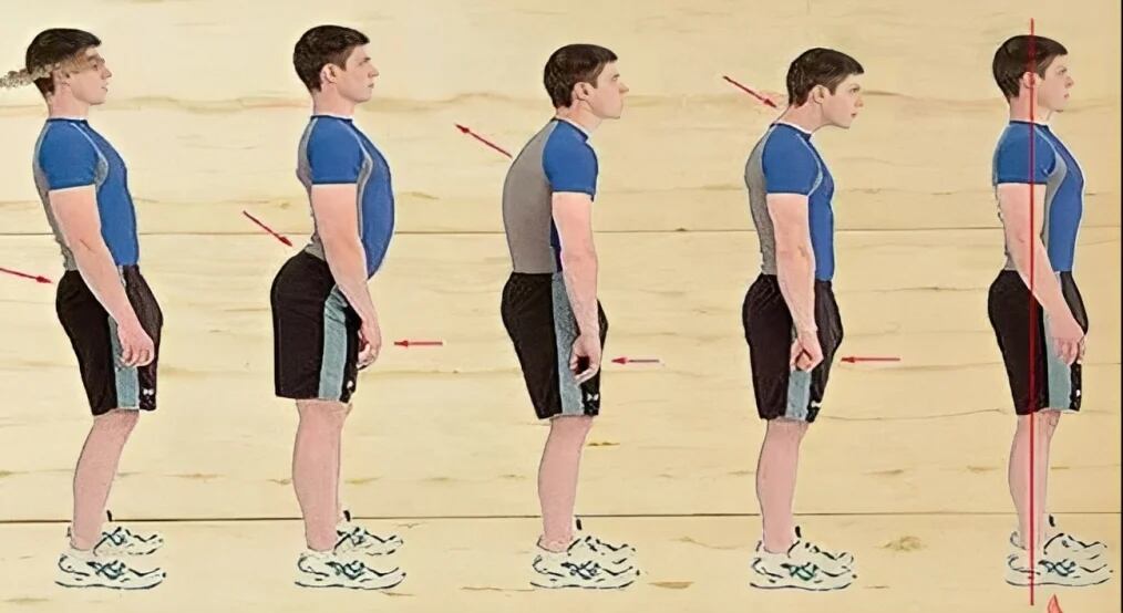 Tu postura erguida o jorobada revelará tus problemas emocionales más fuertes. (Foto: Genial.Guru)