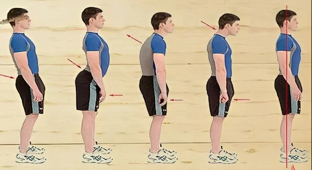 Tu postura erguida o jorobada revelará tus problemas emocionales más fuertes. (Foto: Genial.Guru)