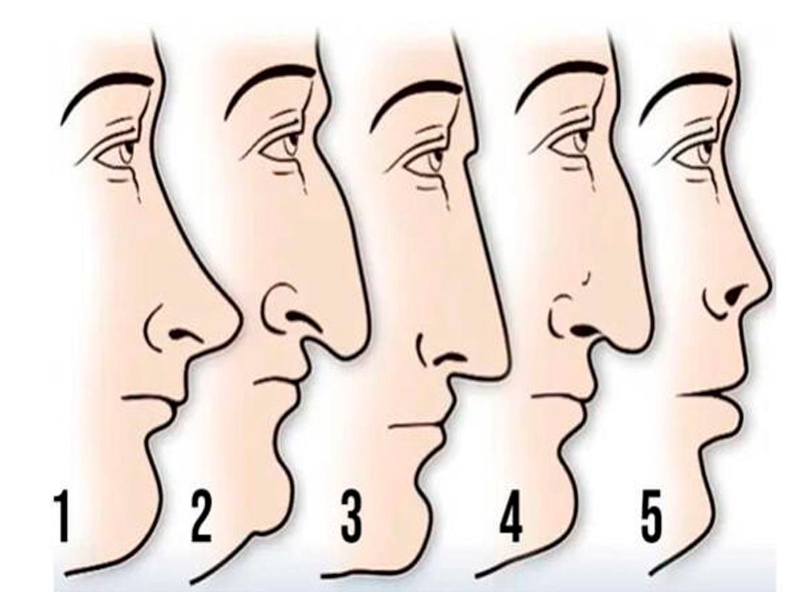 Solo reconoce cuál es la forma de tu nariz y conocerás los resultados del test visual.| Foto: chedonna