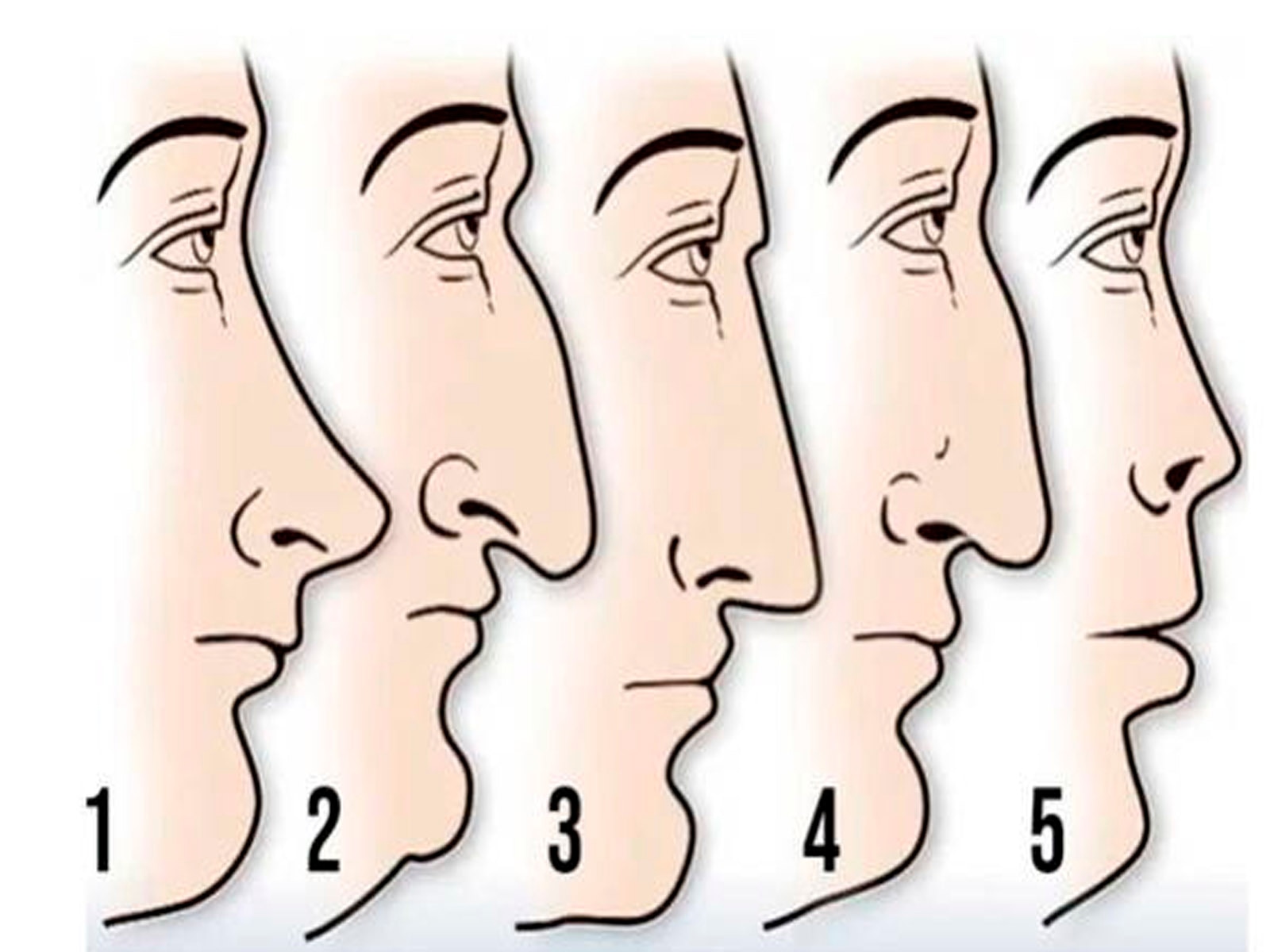 Solo reconoce cuál es la forma de tu nariz y conocerás los resultados del test visual.| Foto: chedonna