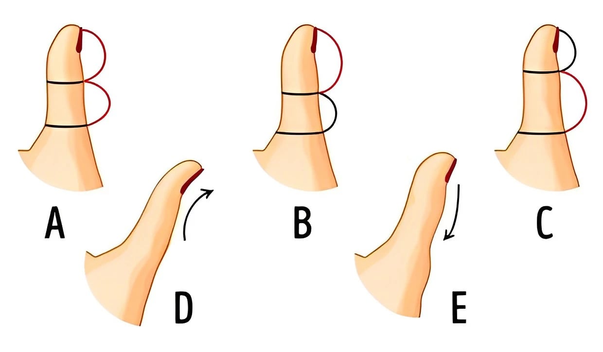 El tamaño de tu dedo pulgar revelará qué tipo de persona eres y cómo piensas (Foto: GenialGuru).