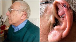 Anciano temeroso del coronavirus va donde un veterinario para que le cosa la oreja que se cortó