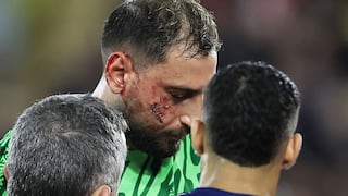 Tras los cortes en su rostro: ¿cuál es el primer diagnóstico de Donnarumma y el tiempo de baja?
