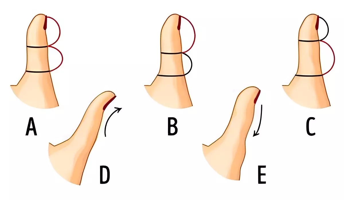 Test visual: el tamaño de tu dedo pulgar revelará qué tipo de persona eres y cómo piensas (Foto: GenialGuru).