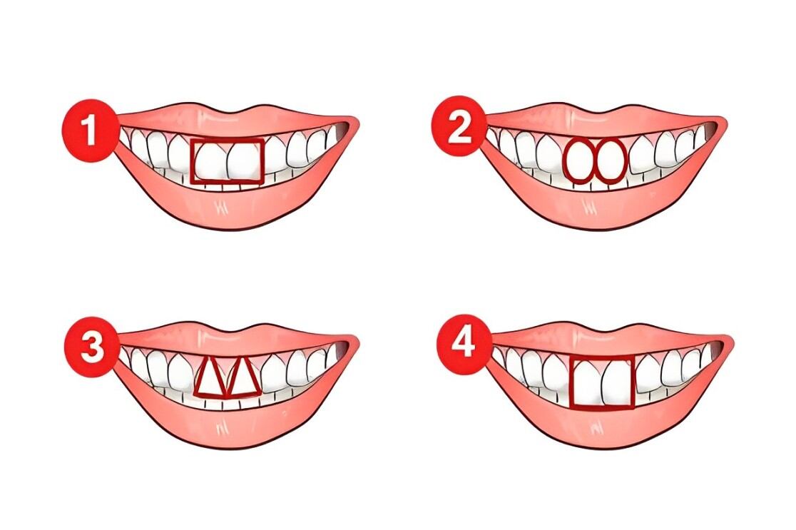Descubre cuál es tu principal característica de acuerdo a la forma de tus dientes (Foto: Namastest).