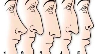 Entérate si eres una persona con complejos, según cuál es la forma de tu nariz