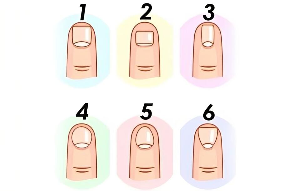 Descubre qué tipo de persona eres en este test visual según la forma de tu uña (Foto: GenialGuru).