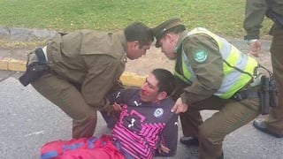 Hincha que quemó camiseta de Perú terminó antes ensangrentado en Santiago