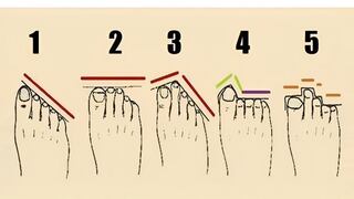 Test de personalidad: la forma de tu pie revelará increíbles rasgos inéditos de ti