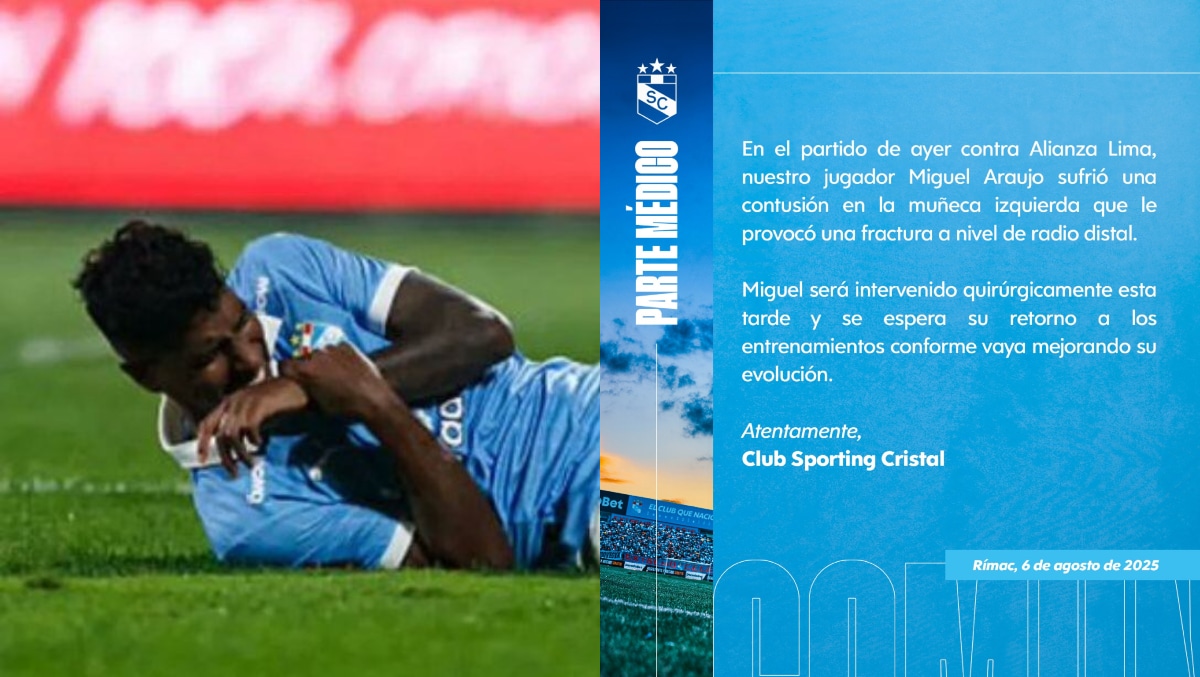 El cuadro 'rimense' confirmó lesión de Miguel Araujo a través de sus redes sociales. (Fotos: Sporting Cristal)