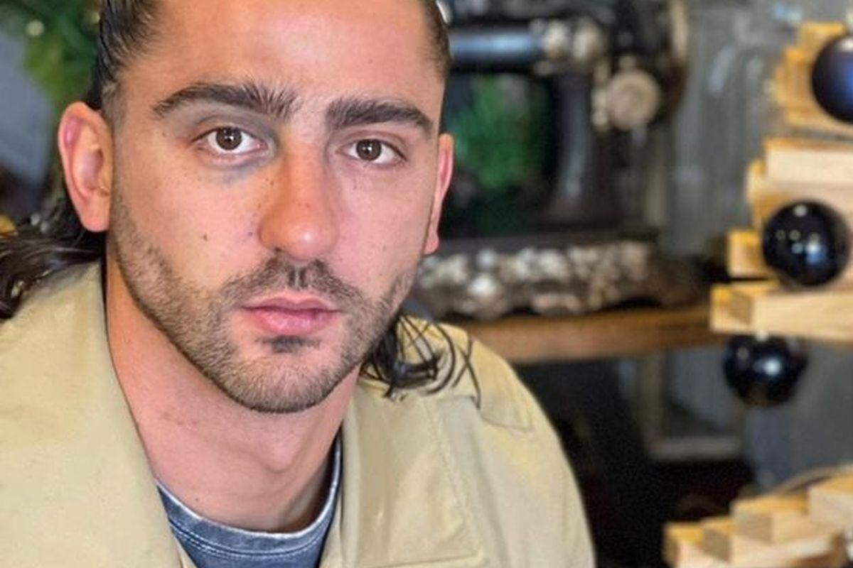 Luis Caballero posee un lado de su vista con tonalidades diferentes (Foto: Potro Caballero / Instagram)