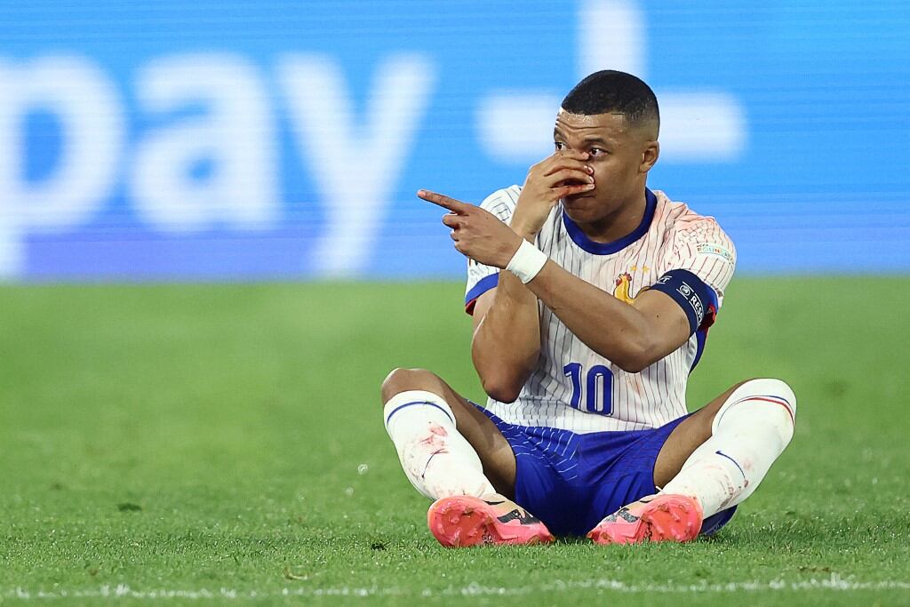 Kylian Mbappé salió del campo tras romperse el tabique en el partido de Austria vs Francia por la Eurocopa 2024. (Foto: AFP).