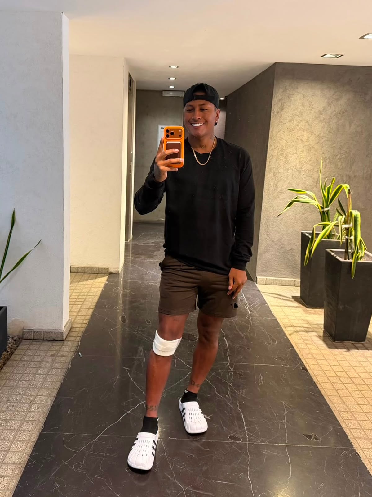 Pedro Aquino volvería al campo de juego en seis meses. (Foto: Pedro Aquino)