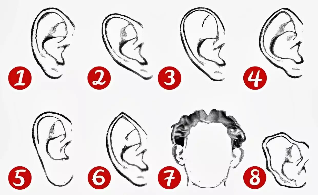 La forma de tus orejas en este test visual revelará rasgos de tu personalidad. (Foto: Archivo).