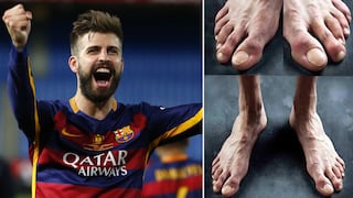 Los pies más feos de los cracks mundiales en el fútbol (FOTOS)