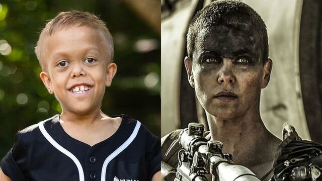 Quaden Bayle, niño con acondroplasia que sufrió bullying, es fichado para la precuela de “Mad Max”
