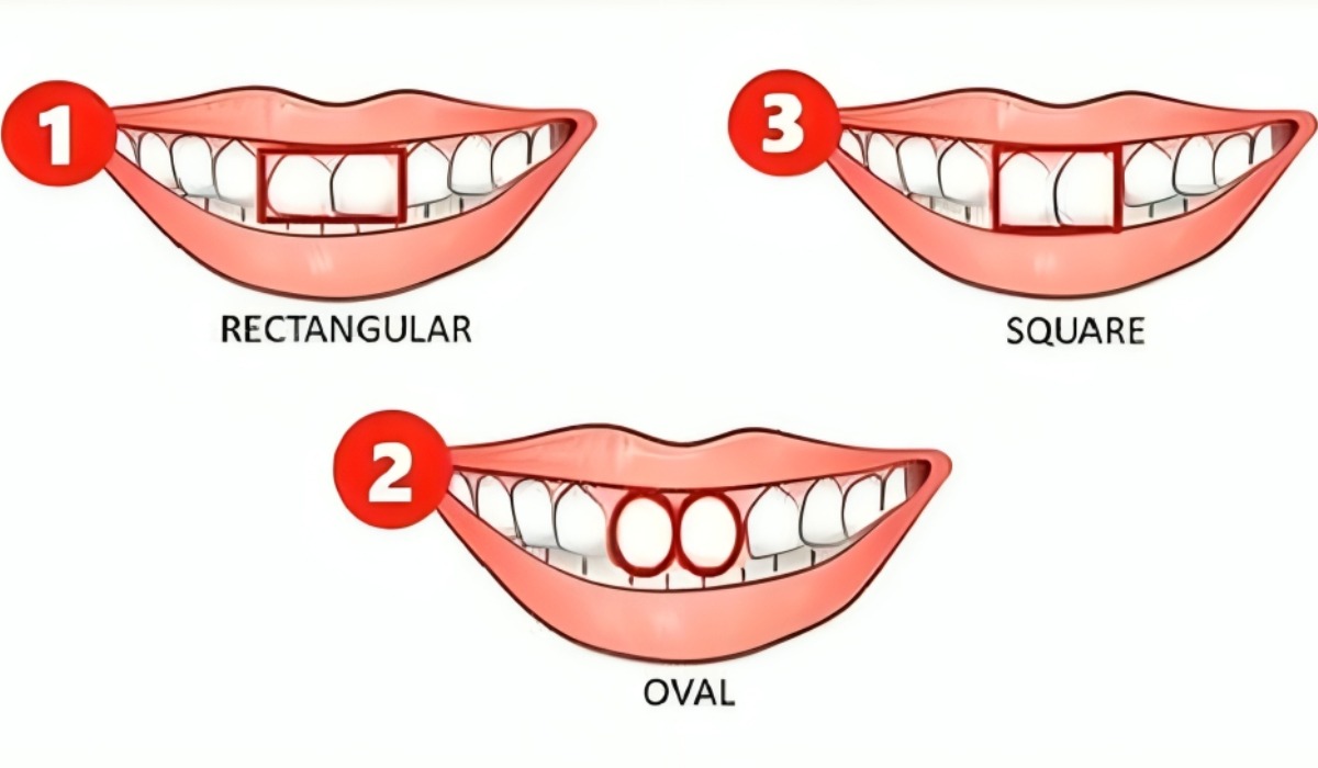 Test visual: descubre qué dice la forma de tus dientes sobre ti de acuerdo a esta prueba (Foto: GenialGuru).