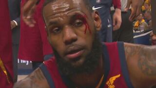 Eso duele: LeBron James quedó ensangrentado tras recibir tremendo codazo ante los Pacers [VIDEO]
