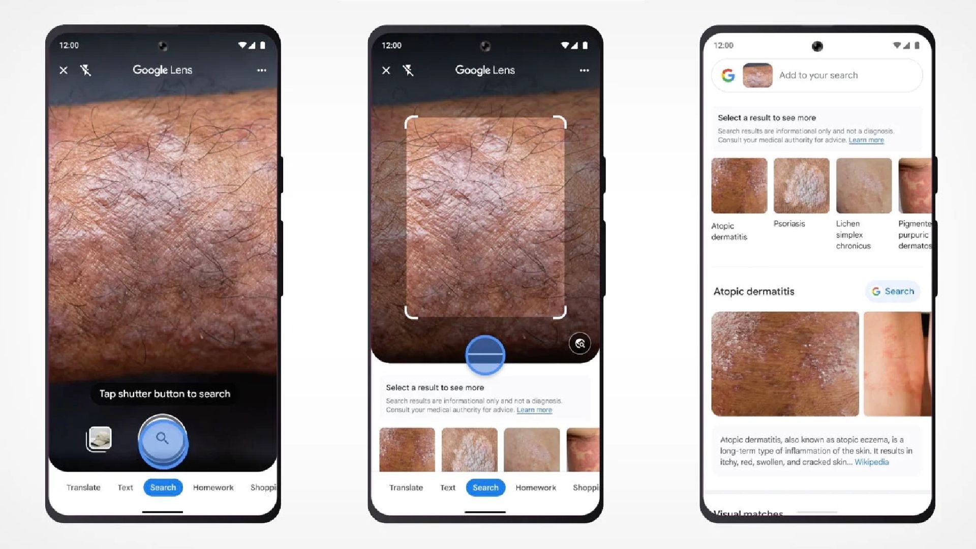 Fases del análisis de Google Lens (Google)