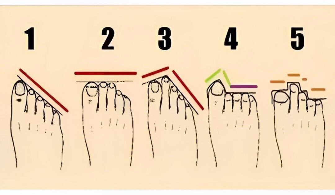 Según la forma que tiene tu pie, descubre qué tipo de persona eres con los demás (Foto: Depor)