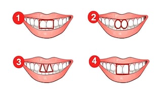 Conoce cuál es tu principal característica según la forma que tienen tus dientes