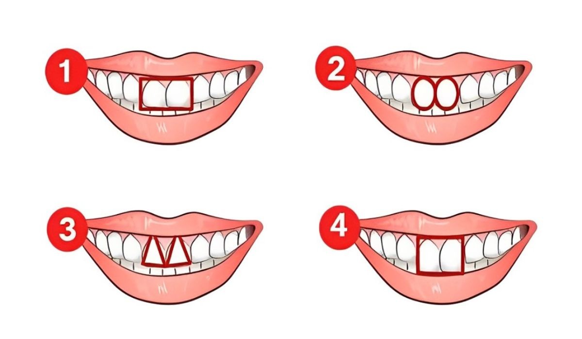 Test de personalidad: descubre cuál es tu principal característica de acuerdo a la forma de tus dientes (Foto: Namastest).