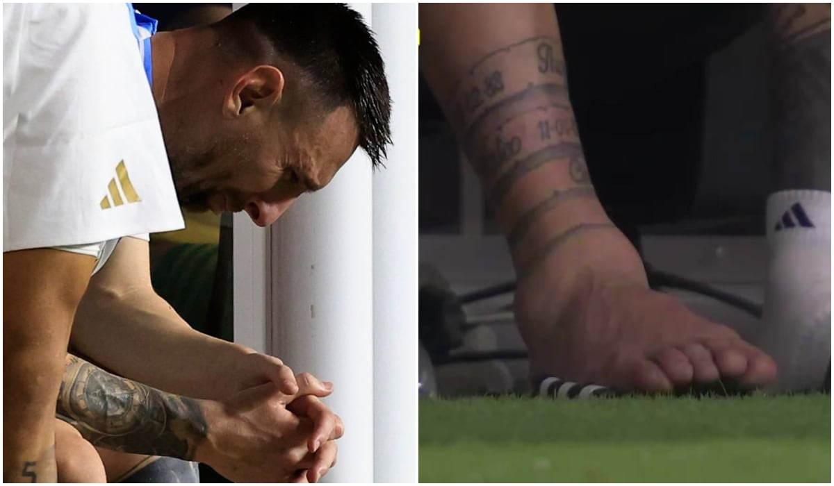 Así terminó el tobillo de Messi en la final de la Copa América 2024. (Difusión)