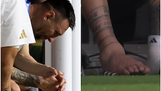 ¡Eso sí debe doler! Así terminó el tobillo de Lionel Messi en la final de la Copa América 2024