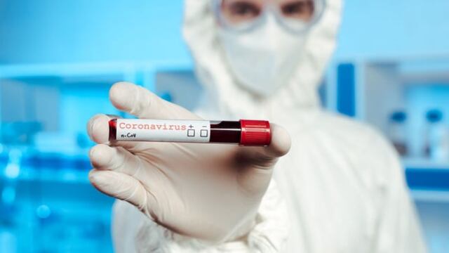 Johnson & Johnson producirá mil millones de vacunas contra el coronavirus para el próximo año