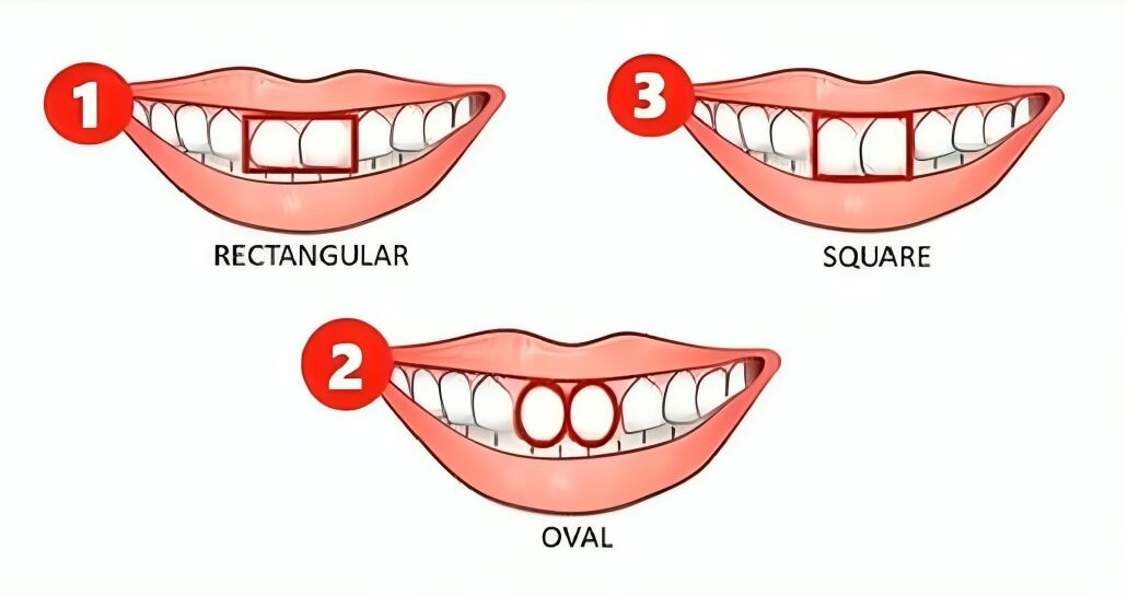 Descubre qué dice la forma de tus dientes sobre ti de acuerdo a este test visual (Foto: GenialGuru).