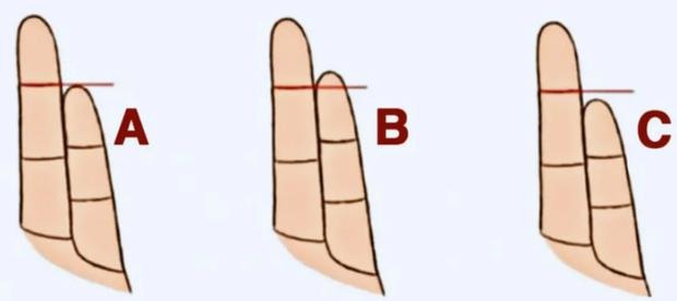 El tamaño de tu meñique según tu anular revelará cuál es tu mayor debilidad. (Foto: Genial.Guru)