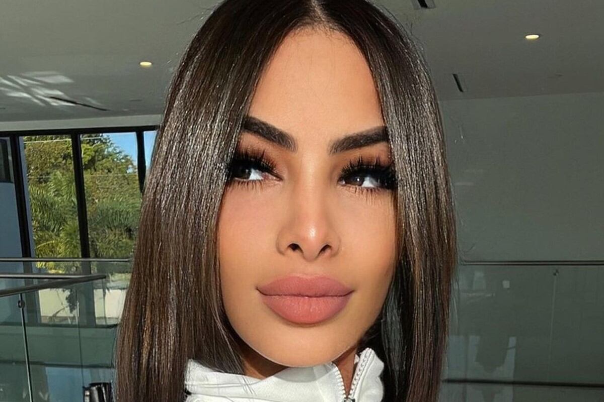 Yailin La Más Viral no oculta los procedimientos a los que se ha sometido. (Foto: Yailin La Más Viral / Instagram)