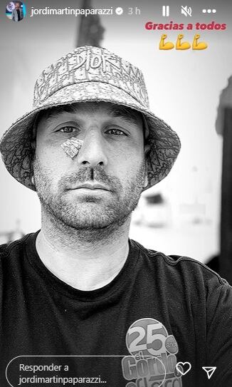 Felizmente, fue operado de urgencia (Foto: Jordi Martín / Instagram)