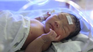 Nadie podía creerlo: bebé nació abrazado al dispositivo anticonceptivo de su madre [FOTO]