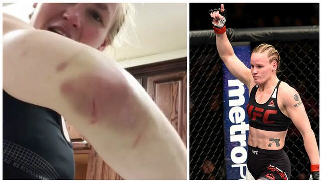 A recuperarse: la lesión que no deja que Valentina Shevchenko vuelva a la UFC [VIDEO]