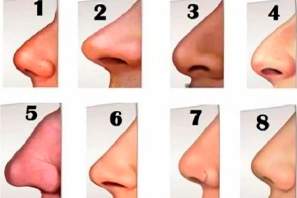 Se aprecian 8 formas diferentes de nariz y tú solo debes escoger aquella que se parezca más a la tuya para conocer así los resultados del test de personalidad.| Foto: namastest
