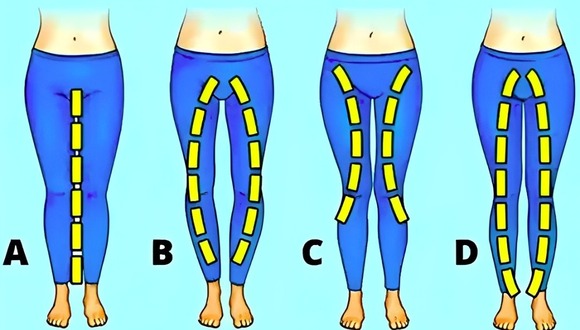 Test de personalidad: la forma de tus piernas revelará detalles inéditos. (Foto: Pinterest)