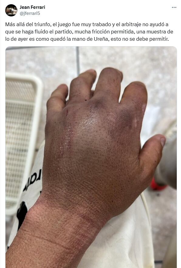 Rodrigo Ureña será evaluado para determinar la gravedad de su lesión.