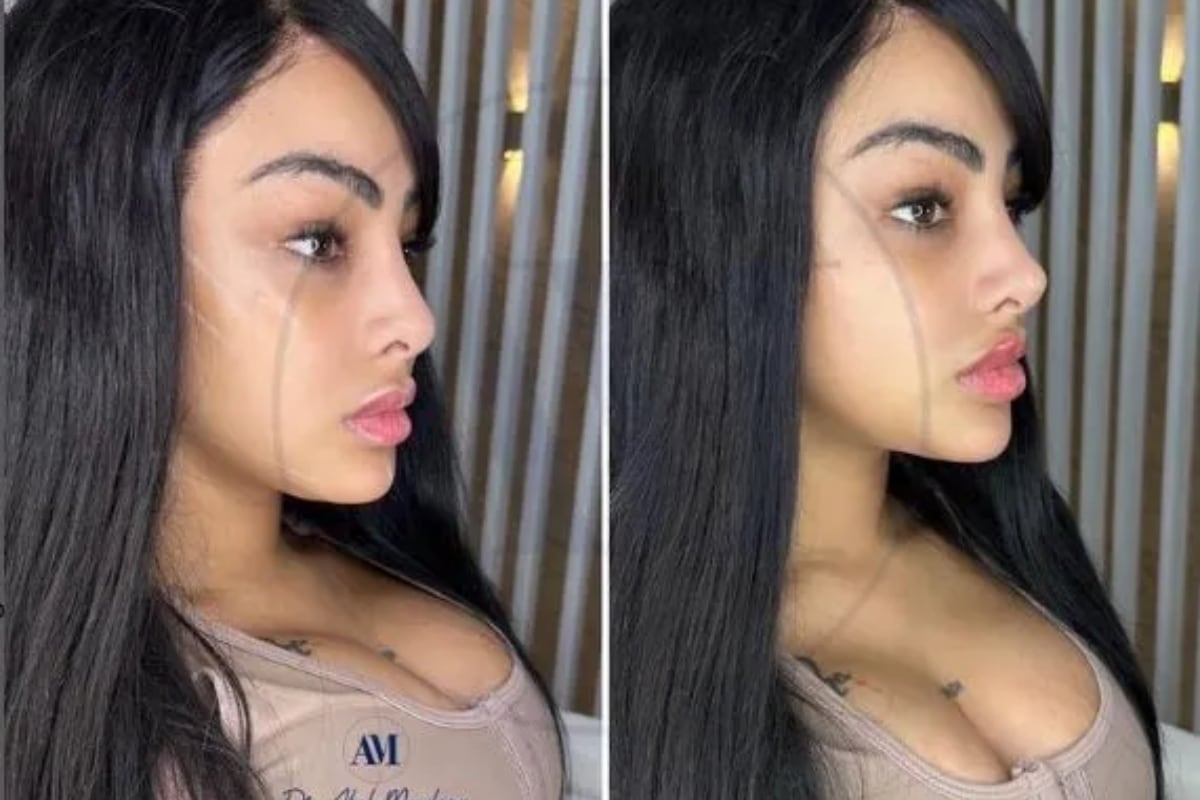 Yailin La Más Viral no oculta los procedimientos a los que se ha sometido. (Foto: Yailin La Más Viral / Instagram)