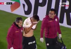 No pudo continuar: Martín Pérez Guedes salió lesionado del Universitario vs. Cienciano