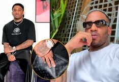 Jefferson Farfán: Descubren curiosa afección que sufre ex delantero