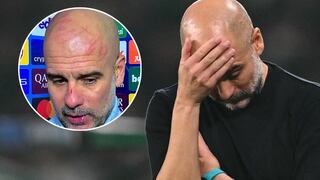 Pep Guardiola apareció con arañazos en el rostro en la conferencia del City: ¿qué le pasó?