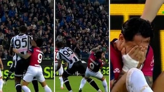 Gianluca Lapadula regresa al Cagliari y sufre golpe en la nariz al chocar con defensor de dos metros