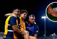 Paolo Guerrero podría perderse el partido clave de Alianza Lima en la Libertadores