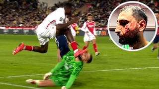 Donnarumma se recupera tras el susto en Mónaco: 10 puntos de sutura en el rostro