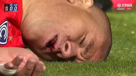 Danilo Ortiz sufrió una grave lesión durante el partido contra Alianza Universidad. (Video: L1 MAX)