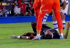 ¡Mateo Antoni ensangrentado! Terrible falta en el Alianza Lima vs. 2 de Mayo