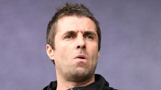 Por qué el ex Oasis Liam Gallagher se resiste a operarse pese a que lo necesita con urgencia
