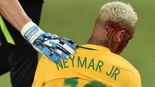 Como con Duk: Neymar y las faltas más duras que ha recibido (VIDEOS)
